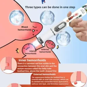 YP1117  Medical Hemorrhoid Laser PenTreat External Internal Hemorrhoids Anus Swelling Pain Relief Laser Pointer Hemorrhoid Treat Bangladesh (New)
