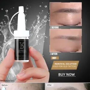 YD Tattoo Removal Solution 10ml CE Certified Transparent Liquid Remover for Clean Eyebrow Lip Eyeliner Pigment Fade Old Tattoos Bangladesh (New)